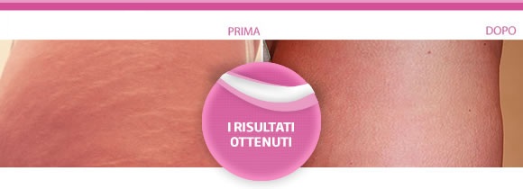 bio